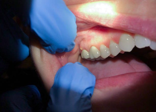 Tooth Infection Emergency Dentist in AR